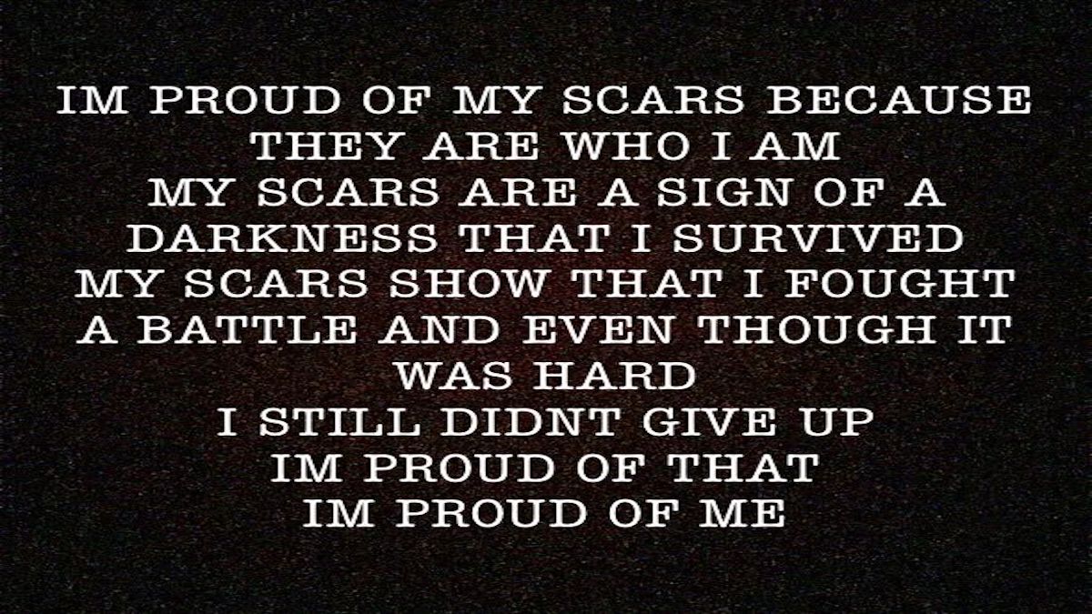 Body Positivity.. I’m a work in&nbsp;progress